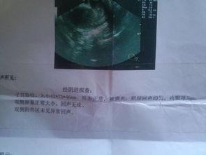 阴道b超视频,女性生殖健康全景扫描